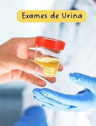 Os exames de urina oferecem valiosas informações sobre o funcionamento dos rins, do trato urinário e são frequentemente usados para diagnosticar infecções, doenças renais, diabetes e distúrbios metabólicos. Dentre os principais podemos destacar: Urina Rotina, Urocultura, Proteinúria, Urografia Excretora, Urina de 24 Horas, entre outros.